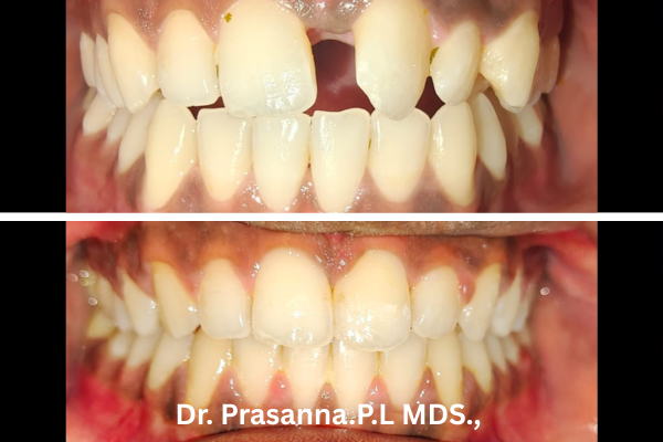 Orthodontics