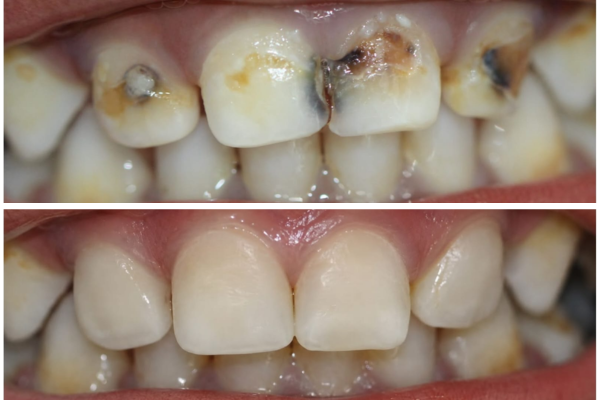 Paediatric Dentistry
