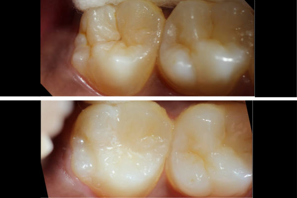 Preventive Dentistry