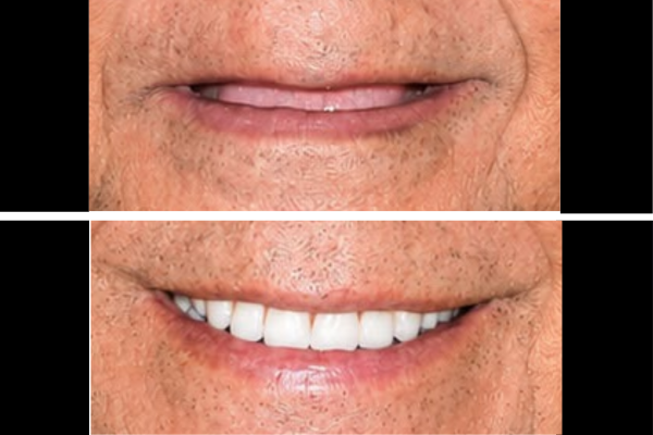 Prosthodontics