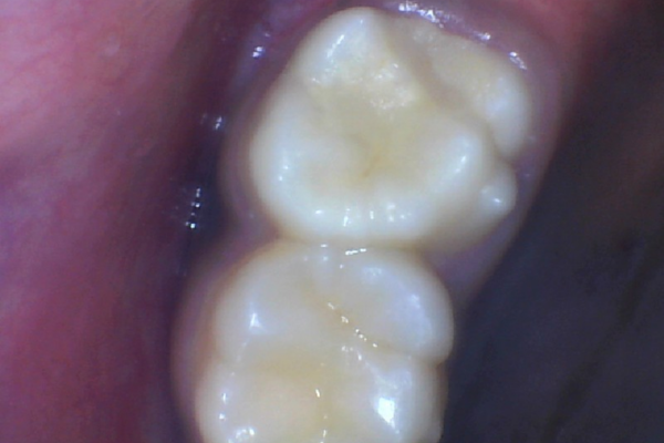 restorative-dentistry